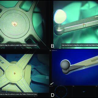 Afbeeldingsresultaten voor Cranial Reference Array
