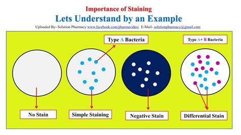 Image result for Simple Staining Technique