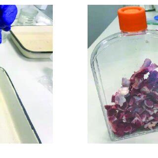 Image result for Process Bone