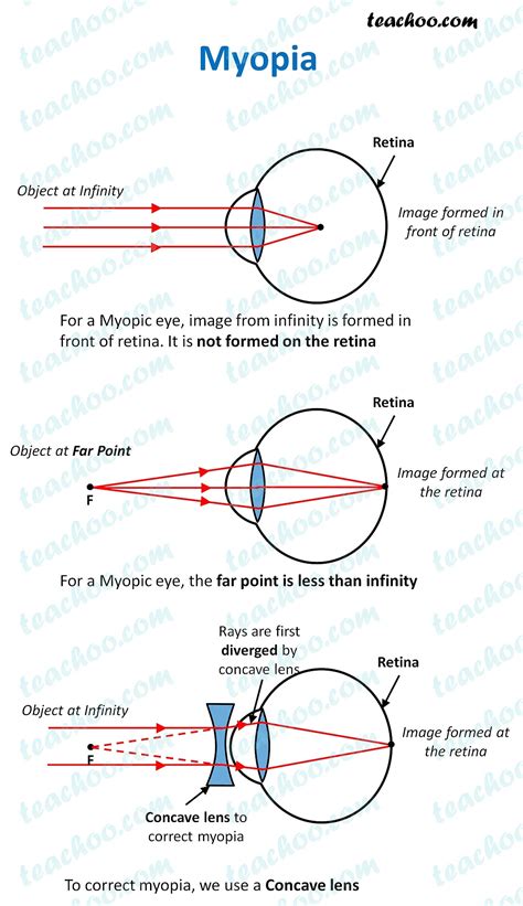 Toradh íomhá ar Eye Diagram That Shos Distant Light Refraction
