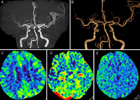 MRA Head Diagram に対する画像結果