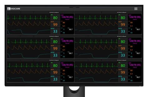 Image result for Telemetry Monitoring