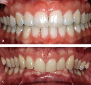 Restricted Envelope of Function に対する画像結果