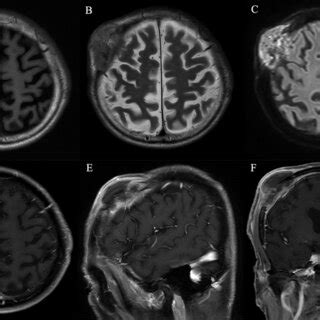 Intensity Normalization に対する画像結果