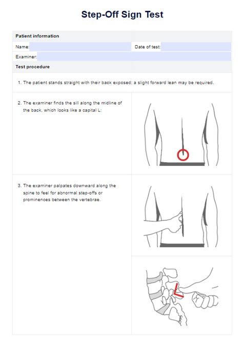 Image result for Procedure for Sign Test