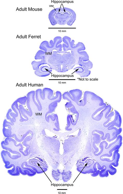 Image result for Mouse Visual Cortex Vs. Human
