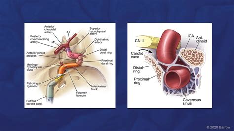 Image result for Hypophyseal Artery Under Microscope