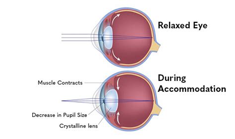 Image result for Accommodation Eye Test