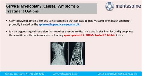 Image result for What Are Symptoms of Cervical Myelopathy