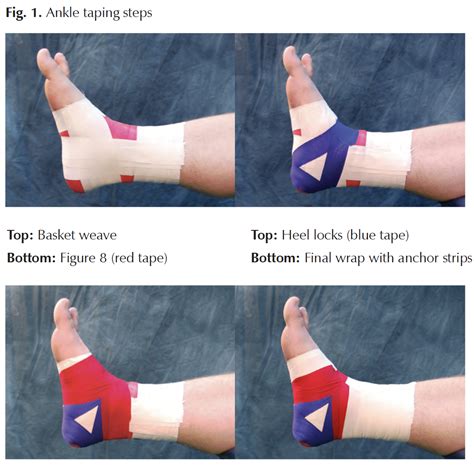Toradh íomhá ar How to Wrap Ankle Sprain