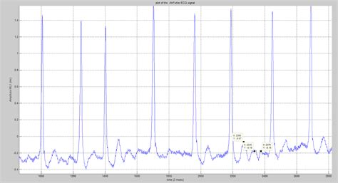 Wavelet Matlab Code ಗಾಗಿ ಇಮೇಜ್ ಫಲಿತಾಂಶ