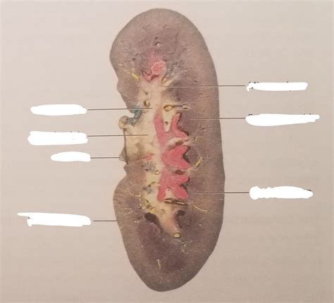 Toradh íomhá ar Microscopic Structural Pattern Diagram of Kidney