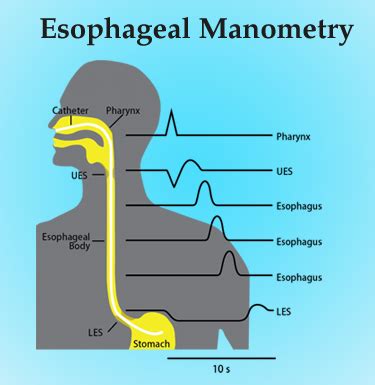 Image result for Normal Manometry