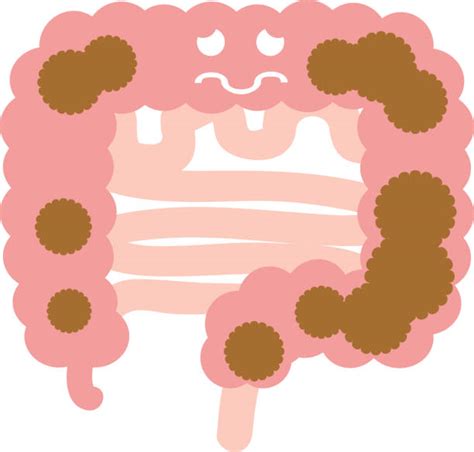 Blockage in Intestines に対する画像結果