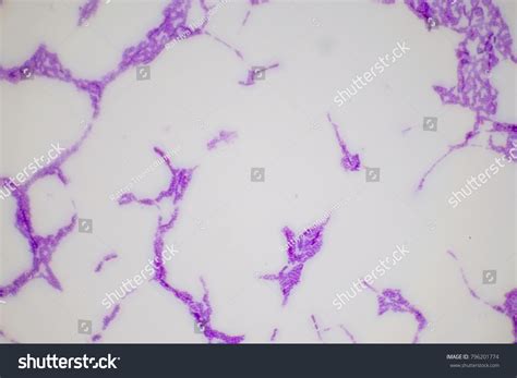 Bacteria Microscope Slides に対する画像結果