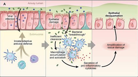 Image result for Asthma Pathophysiology Novartis