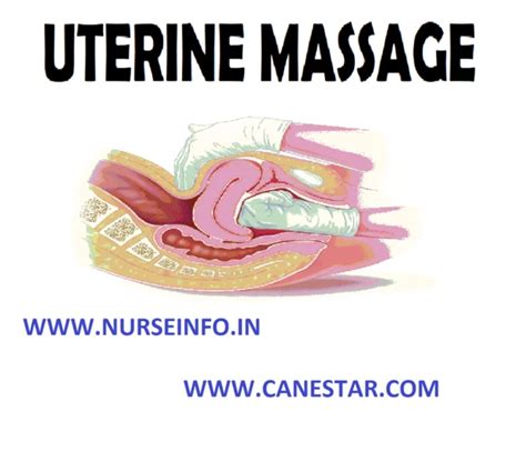 Image result for How to Give Fundal Massage Step by Step