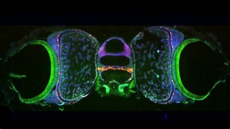 Toradh íomhá ar Octopus Vision