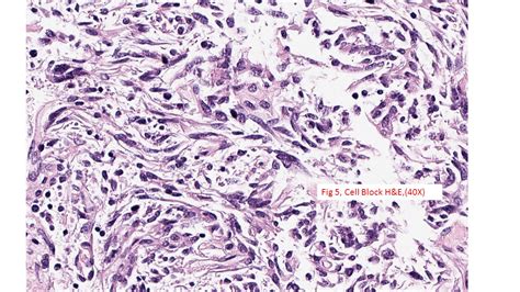 Image result for Cell Block H 32