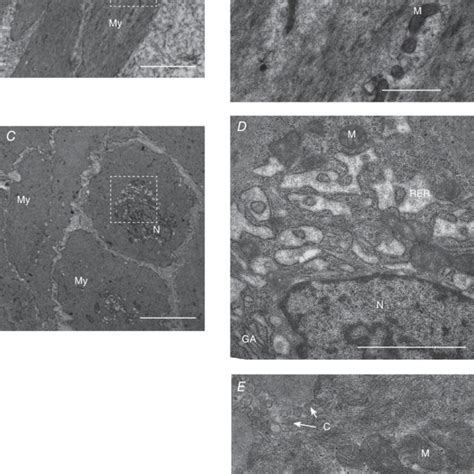 Mitochondria in Myocyt に対する画像結果