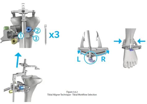 Afbeeldingsresultaten voor Computer Assisted Instrument Definition