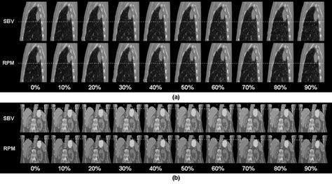 Image result for 4D CT Scan