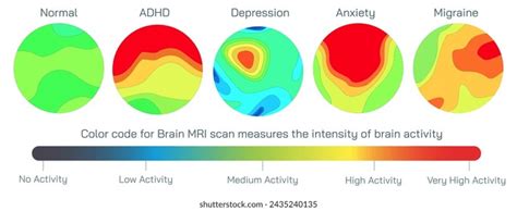 Image result for MRI Scanner Prefrontal Cortex