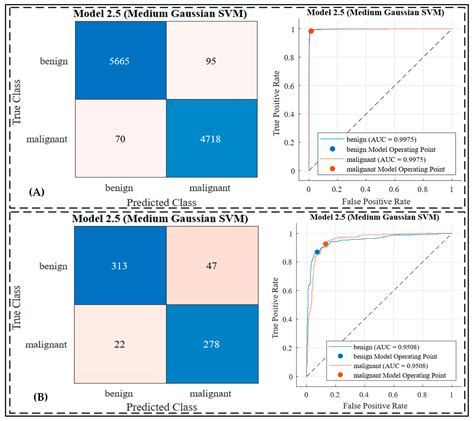 Image result for Skin Cancer Detection Using CNN