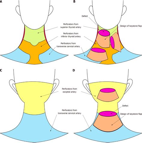Toradh íomhá ar Sizes of Cutaneous Defect