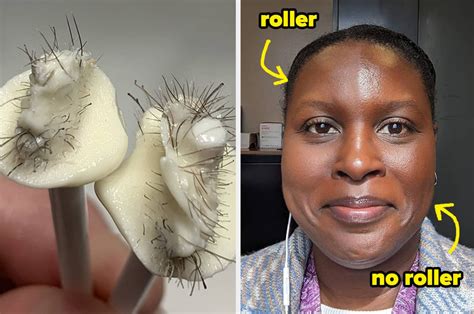 Image result for Normal Problems