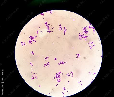 Gram Stain of Streptococcus 的图像结果