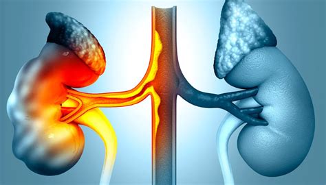 Mayo Clinic Parkinson's Disease に対する画像結果