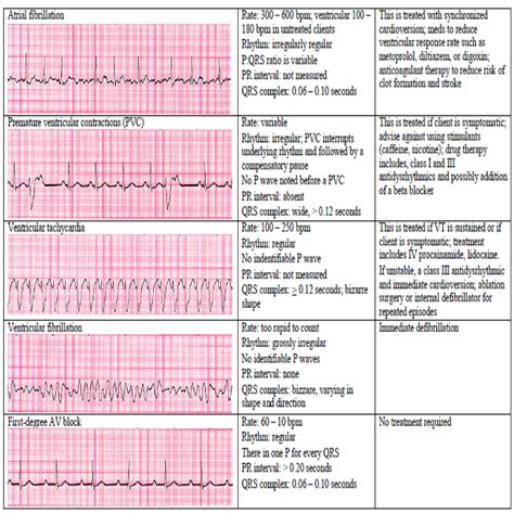 Image result for Paced Rhythms Cheat Sheet