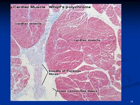 Cardiac Muscle Tissue Slide Labeled