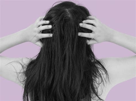 Itchy Rash On Scalp కోసం చిత్ర ఫలితం