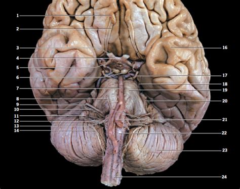 Image result for Nerve Tract Labeled