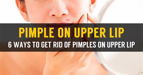 Image result for Lip Pimple Exploding