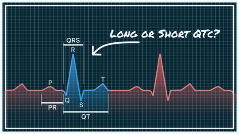 Toradh íomhá ar Normal QT Interval ECG