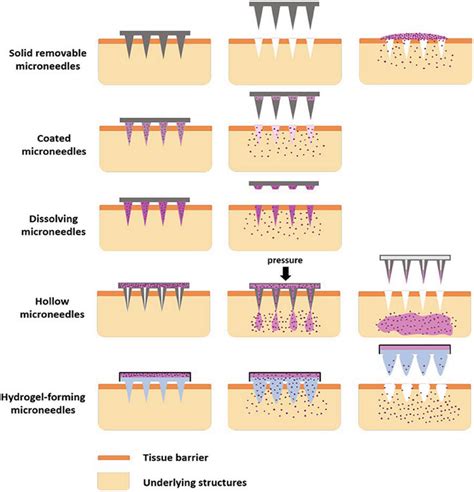 Image result for Separable Effervescent Microarray Patch