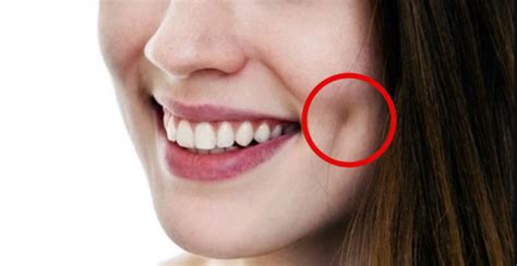 Image result for Cheek Dimples