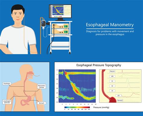 Image result for Manometry Machine
