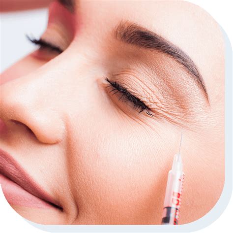 Dysport Botox Injections ಗಾಗಿ ಇಮೇಜ್ ಫಲಿತಾಂಶ
