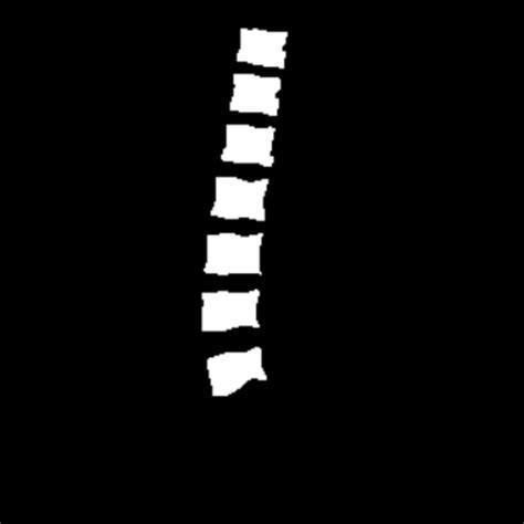 Image result for Spine Segmentation Python