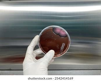 Afbeeldingsresultaten voor Coliform On EMB