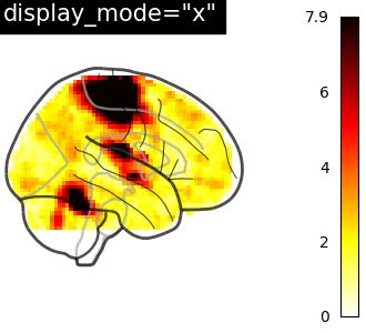 Python Glass Brain に対する画像結果
