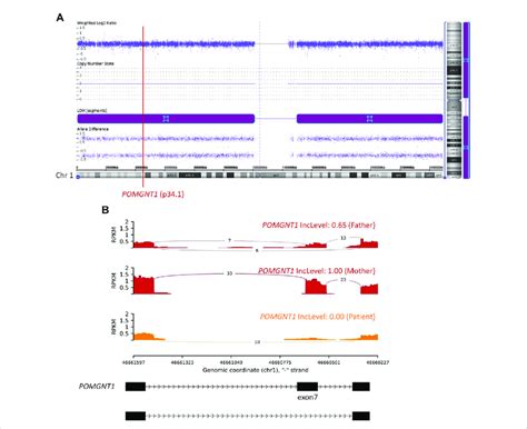 Image result for What Is Chromosomal Microarray Analysis