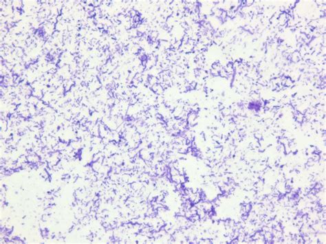 Bacteria Microscope Slides に対する画像結果