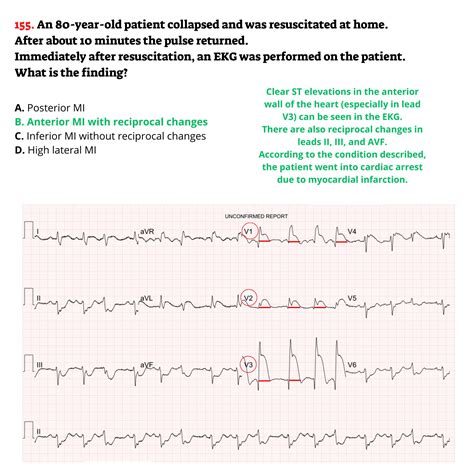 Image result for EKG Tech Practice Test