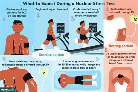 Toradh íomhá ar Stress Test Procedure