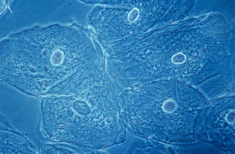 Image result for Cheek Cell Microscopic View